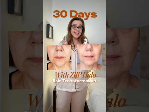 What 30 days of micro + nanocurrent did to my skin #antiaging #microcurrentdevice #nanocurrent #ziip