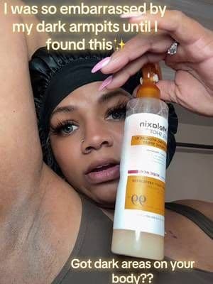 You will not be disappointed! The body peel shot works on all dark areas! Brightens in minutes! Grab yours in the orange cart and thank me later✨ #darkspots #drmelaxinpeelshotrealreview #drmelaxin #peelshot #tiktokshop @Dr Melaxin Official