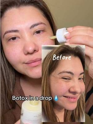 Lab in Nature Retino 0.2 Boosting Shot Ampoule 30ML, Serum for Skin Repair, Hydrating Formula. Slow down aging skin, start using a retinol serum with spicules that acts as micro needling in a bottle! SKIN1004 has created such a amazing Korean skin care line. So good for aging and mature skin . #serum #skin1004 #centella #koreanskincare #tiktokshopmademebuyit @SKIN1004 US
