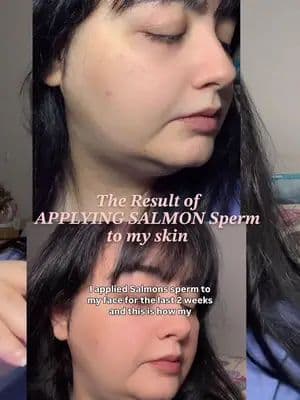 I finally found the serum that actually works! 😍✨ The Salmon PDRN Pink Peptide Serum from @medicube global changed my skin dark spots faded, barrier feels stronger & my glow is unreal 💖 This is your sign to start your skin story ✨ @medicube global @medicube US Store #medicube #amazon #amazonmusthaves #pdrn #kojicacid