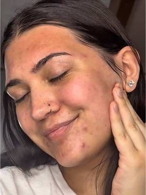 This set had my skin looking so glowy and feeling so moisturized😍 I’m in love with everything I have received from @medicube global ❤️ • • #tiktokshop #medicube #medicubetiktokshop #freesample