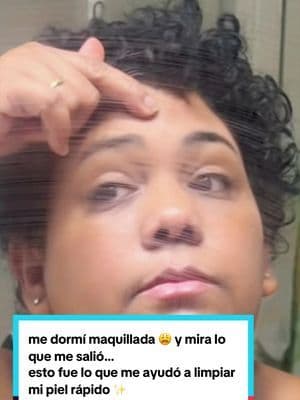 No te duermes con maquillaje, nos puedes salir de Anita mira lo que me pasó me dormí con maquillaje y me salieron granos por eso me estoy limpiando con la doble Limpieza de Medic Yura, la cual cuenta con un aceite desmaquillante, el cual solamente no te ayuda des maquillar, sino que también te ayude a eliminar la sociedad y las impurezas del día. Después me lave el rostro con el jabón de PRN al 99%, el cual te ayuda a hidratar y a limpiar tu rostro a profundidad, lo cual te ayuda a mejorar la elasticidad.@medicube US Store #doblelimpieza #pdrn #skincare #skincareroutine #piellimpia #medicube #pdrnhydratinggelcleanser #medicubekojicacidturmerictoningcleanser #glowrecipeblueberrybouncegentlecleanser #medicubeblackfridaypdrncollagencapsulecream #cleanseandhydrate #hydratingfacialcleanser #thefaceshopdoublecleanser #medicubedoublecleanser #medicubedoublecleansingduo #nidaperfectclearoiltofoamdoublecleanserfacial #skin #tiktokshop #mom #beauty #beautyskin #skincare #skincareroutine #tiktokshop