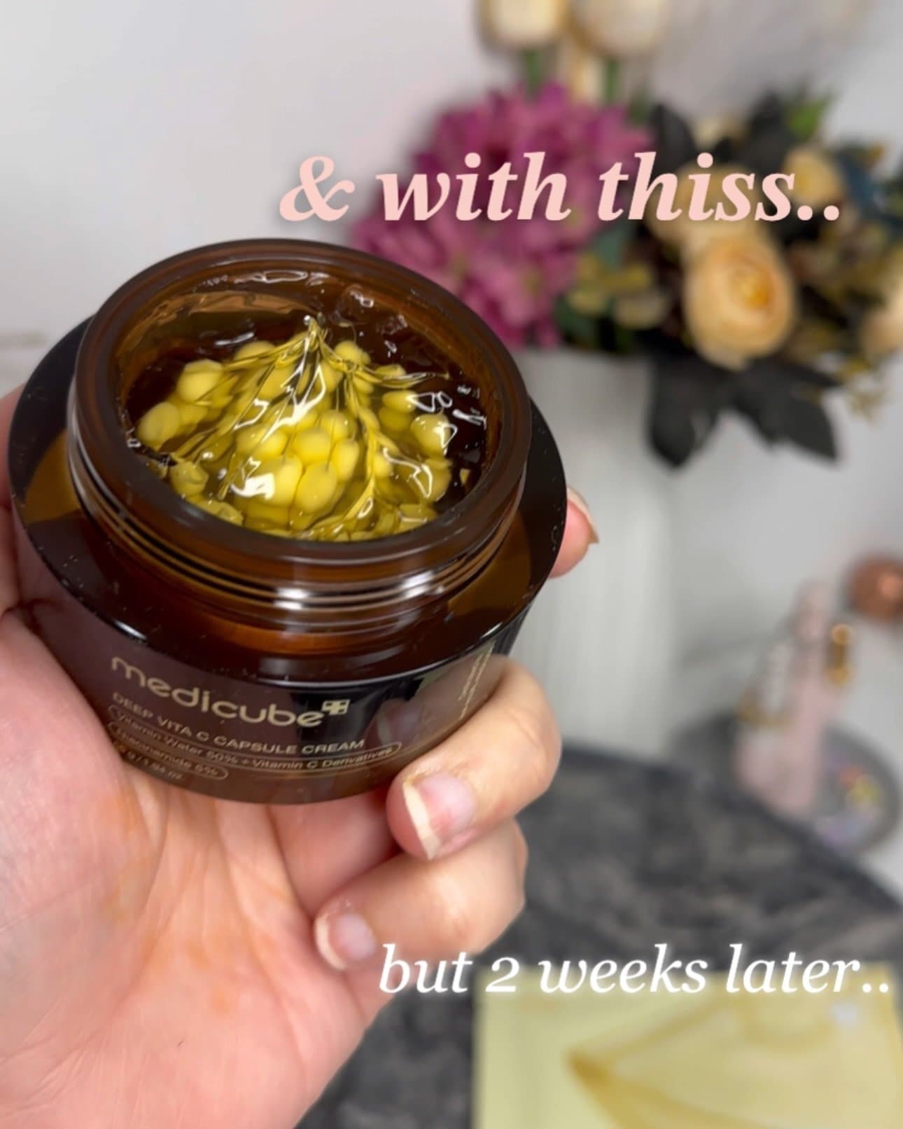 Post-acne scars? Hyperpigmentation? I feel you.
For weeks, I struggled with uneven skin tone — until I found this glow-