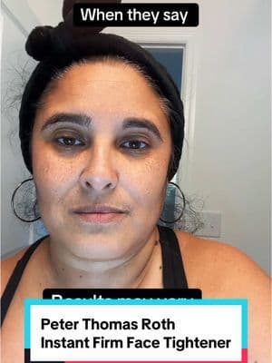 Peter Thomas Roth instant Firm face tightner has worked for so many mature women. Read the reviews. This works best on someone who have deep fine lines and wrinkles. If this is you, grab it while is on sale! #peterthomasroth #peterthomasrothinstantfirmx #instantfirming #facetightening #tiktokshopcybermonday #tiktokshopholidayhaul
