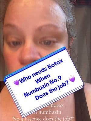 #creatorsearchinsights #creator #ugccreator @numbuzin Official @Numbuzin_us @numbuzin ⭐️💜⭐️💜⭐️💜⭐️💜⭐️ Revolutionary anti-aging cell booster 💜⭐️💜⭐️💜⭐️💜⭐️💜 #NAD + #BIO #no9nadbioliftingsilessence #essence for #lifting #firming , #wrinkles #fineline #elasticity #peptides, NAD+ | works to #reduceaging and #opaque #skin . You don't need botox!!! This #liftingessence does it all!! #skincareisselfcare #skincareproductsmusthave #skincaretiktok #skincaretok #nad #skincare #koreanskincare #essence #botox #peptide #antiaging #kbeauty #skincareroutine #glowingskin #skincarehacks #viralskincare #BeautyTok #numbuzinno9 #skincarecommunity #skincareproductsthatwork ⭐️💜⭐️ ⭐️ 💜 ⭐️ 💜 ⭐️ 💜 ⭐️ 💜 ⭐️ #tiktokshop #tiktokpartner #tiktokviral ⭐️ #glowyskin #glowy