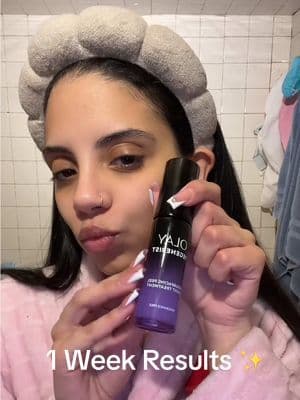 One week using the Olay Regenerist Resurfacing Peel Night Treatment ✨ So far loving how easy it is to add into my nighttime routine. #OlayUGC #gifted #onlyolay @Olay Skin Care @chimeable