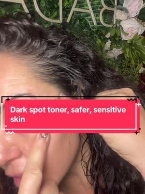 Excellent for those with sensitive skin to work on treating blemishes and minimizing dark spots @dear, Klairs #tiktokshopcreatorpicks #tiktokshopholidayhaul #pdrntoner #sensativeskin #darkspottreatment