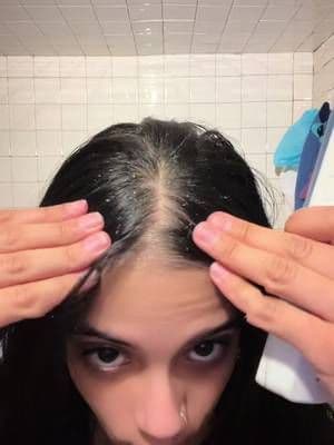 Trying the CeraVe 2-in-1 Anti-Dandruff Hydrating Shampoo & Conditioner for the first time and my flakes were gone after