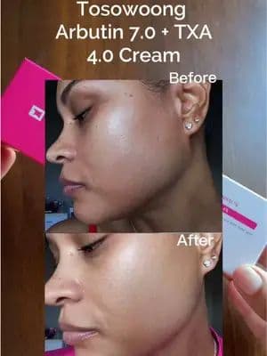 Tosowoong Arbutin Cream is available on Amazon! #tosowoong #arbutincream #kbeauty #amazonbeauty #amazonfinds @TOSOWOONG US