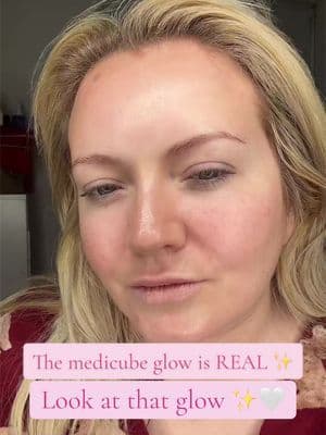 The glow is insane ✨🤍#medicube #skincare #tiktokmademebuylt #mum #tiktokmademebuyituk @medicube UK @medicube global