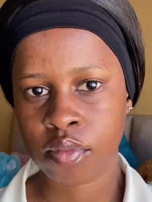 I have been suffering from sturbborn dark marks/ spots and I have been using Garnier Even & Matte Vitamin C serum, and I have been seeing the difference (the dark spots are fading and I’m happy) #garnierbrightnation #sayitbright #garnierza #garnierskin #Gifted @Garnier_SA