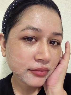 My honest experience with the TikTok famous Zombie Pack mask. Smaller pores at home! ✨@SKIN1004 US . . . . #SKIN1004, #tiktokshopcreatorpicks, #koreanskincare, #centella, #skincare