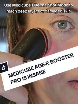 The Medicube booster pro facial device is insane #facial #medicube #medicubeboosterpro #koreanskincare #kbeauty #skincaretips #viralskincare #skincare #skincareroutine #skincareproducts #tiktokshopblackfriday #tiktokshopholidayhaul #tiktokshopcybermonday #koreanskincare #tiktokshopfinds #tiktokshopdeals