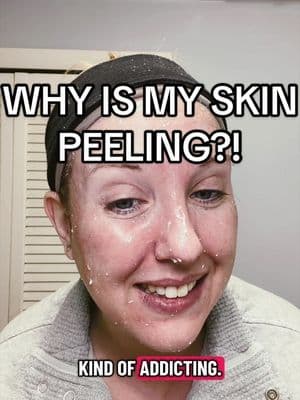 Okay wait. Why does it look like my skin is literally rolling off? This is a peeling gel — it lifts dead skin without h