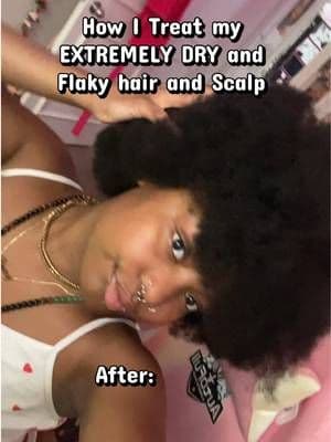My hair feels so much better. Sadly I have a scalp condition so it’s really hard to treat. I’m so happy to have this now #medicube #baezy #tiktokmademebuyit #viral #hair
