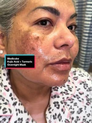 Kojic acid, turmeric, vitamin C AND retinol in one night mask? 👀 It’s a lightweight gel that I use as my last step on nights when I want glow but not grease. I go to sleep shiny, and wake up with softer, smoother skin that looks a *little* more even every week. Is it a magic eraser? No. Is it helping my dullness and spots look less angry while my actives and SPF do the long-term work? Yes. If you’re over 40/50 with melasma, combo skin… this might be one to try👇🏽 Tap the cart to see ingredients, reviews, and current promo, and save this so you remember which kojic acid mask I tried for us. #t#tiktokmademebuyitm#matureskino#over50skincareg#genxlatinarealskin Kojic acid turmeric night mask review on mature combo skin with melasma and dark spots. Testing a Medicube kojic acid vitamin C and retinol sleeping mask on over 50 skin in menopause, with real texture and hyperpigmentation. Nighttime routine for dark spots, dullness, and uneven tone, showing how it layers over hydrating serums and under SPF the next morning. Skincare for women over 40 and 50, Gen X Latina with combo/oily skin in a dry climate looking for brightening without irritation. TikTok Shop skincare review, honest first impressions and realistic expectations for dark spot routines.