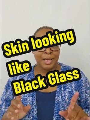Skin went from "You Good" to BLACK GLASS real quick. #TikTokshop #torriden #ugccreator #kbeautyfinds
