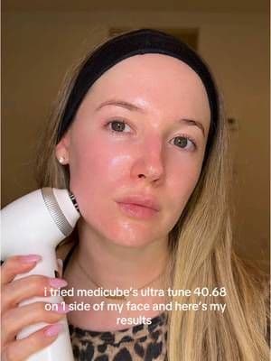 korea is living in the future #medicube #ultratune #medicubeambassador #tiktokshop #tiktokshopfinds #beautymusthaves #kskincare #kbeauty #glassskin #UltraTune #WrinkleIroning @Medicube Global @medicube