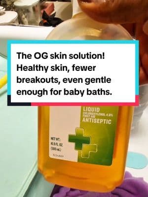 Replying to @stace.a.base.frequency Healthy skin, fewer breakouts, gentle enough for baby baths... Caribbean homes knew the secret all along. Dettol isnโt just for cuts. Itโs for care. โฆ #DettolTradition #HealthySkin #CaribbeanWellness #TikTokShopFinds #AcneTok #BabySafeCare #HyperpigmentationHelp #CleanSkinRoutine #MomLifeApproved #TikTokShopRestock #TikTokShopCreatorPicks #Fanttik5thAnniversary #SuperbrandDay #QVCTikTokSuperBrandDay #IfYouKnowYouKnow